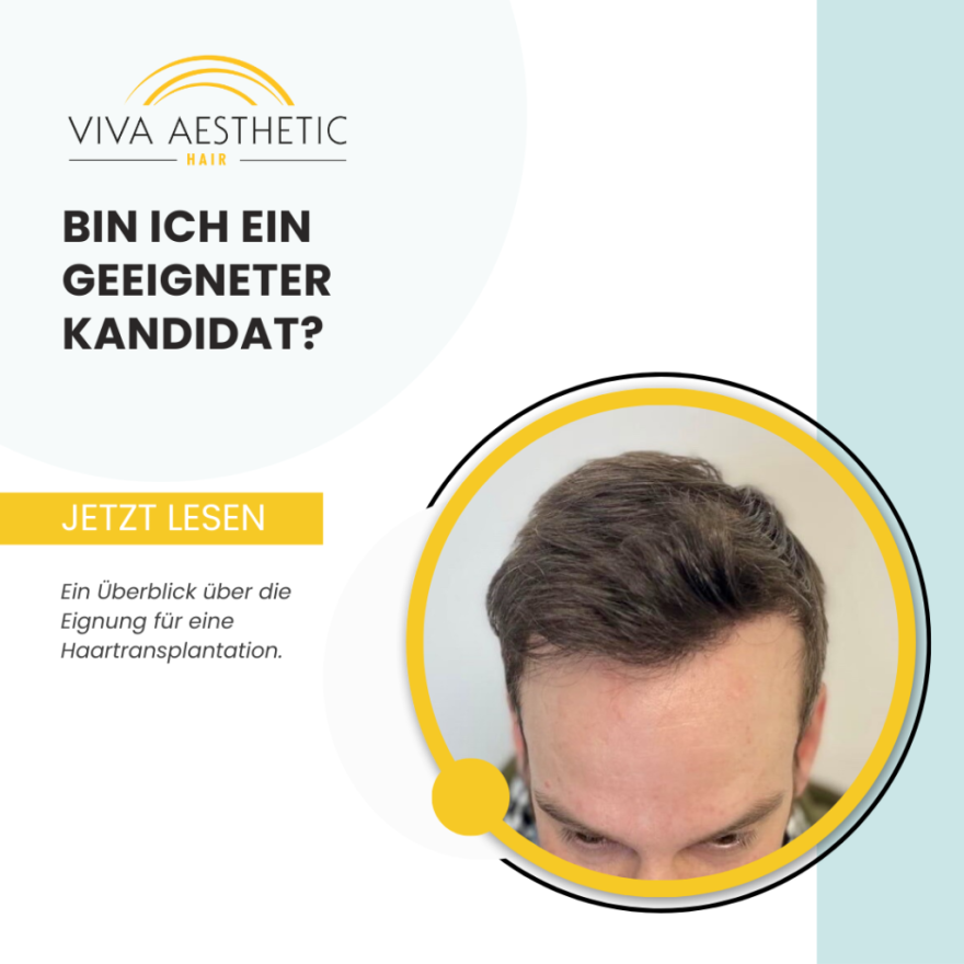 Bin ich geeignet für eine Haartransplantation